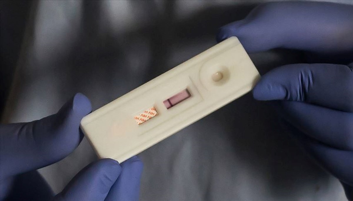 Avrupa HIV Test Farkındalığı Haftası Türkiye'de de hayata geçiriliyor