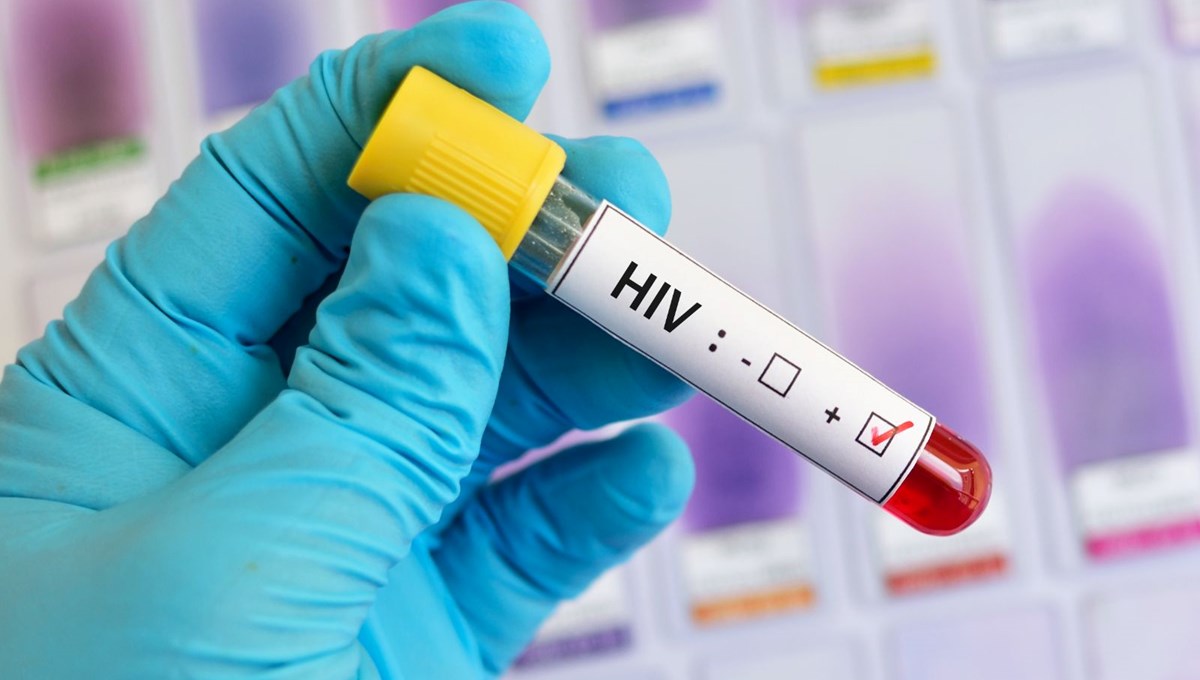 Gana'da AIDS kabusu: Bir yılda 9 bin 354 can kaybı